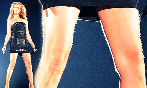 Celine Dion sin depilar